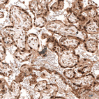 Anti-PARP14 Antibody