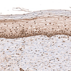 Immunohistochemical staining of human uterine cervix shows strong nuclear positivity in squamous epithelial cells.