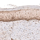 Immunohistochemical staining of human uterine cervix shows strong nuclear positivity in squamous epithelial cells.
