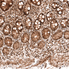 Immunohistochemical staining of human small intestine shows strong nuclear positivity in glandular cells.