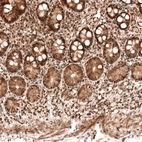 Immunohistochemical staining of human small intestine shows strong nuclear positivity in glandular cells.