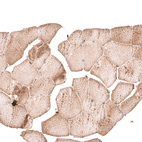 Immunohistochemical staining of human skeletal muscle shows no nuclear positivity in striated muscle fibers as expected.