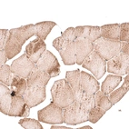 Immunohistochemical staining of human skeletal muscle shows no nuclear positivity in striated muscle fibers as expected.