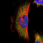 Immunofluorescent staining of human cell line U-251 MG shows localization to cytosol.