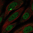 Immunofluorescent staining of human cell line SiHa shows localization to nucleoplasm & nuclear bodies.