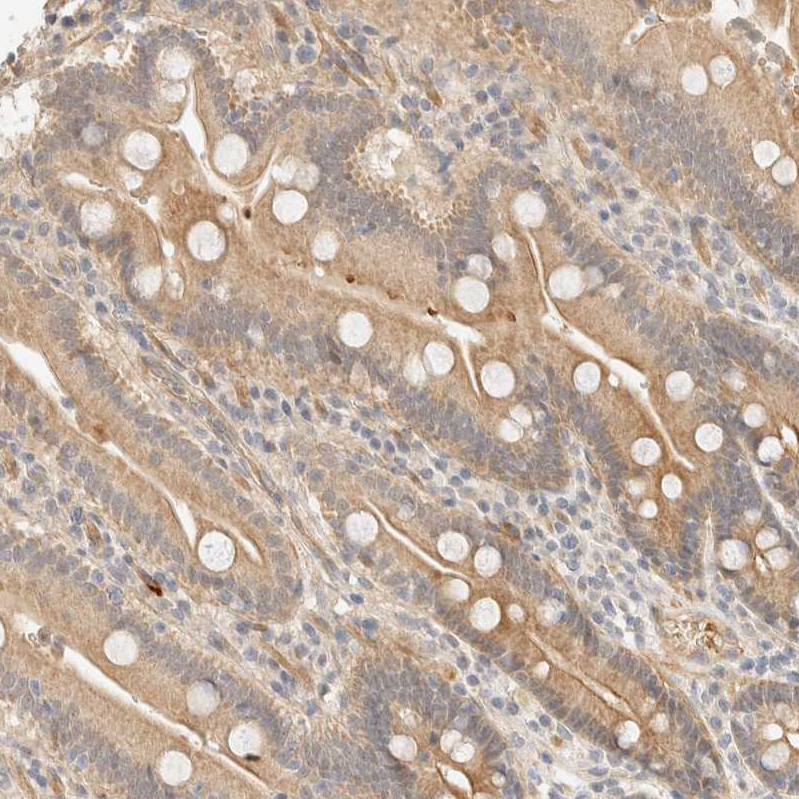 Anti-TNK1 Antibody