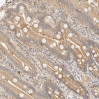 Anti-TNK1 Antibody