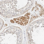 Immunohistochemical staining of human testis shows moderate cytoplasmic positivity in Leydig cells.