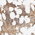 Immunohistochemical staining of human bone marrow shows moderate cytoplasmic positivity in hematopoietic cells.