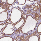 Anti-PRAG1 Antibody