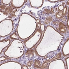 Anti-PRAG1 Antibody