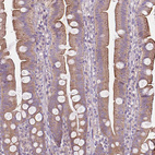 Immunohistochemical staining of human duodenum shows weak to moderate cytoplasmic and membranous positivity in glandular cells.