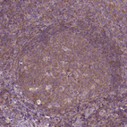 Immunohistochemical staining of human tonsil shows moderate cytoplasmic positivity in germinal center cells.
