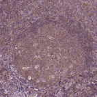 Immunohistochemical staining of human tonsil shows moderate cytoplasmic positivity in germinal center cells.