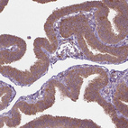 Immunohistochemical staining of human Fallopian tube shows moderate cytoplasmic positivity in glandular cells.