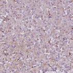 Immunohistochemical staining of human liver shows low positivity in hepatocytes as expected.