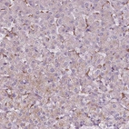 Immunohistochemical staining of human liver shows low positivity in hepatocytes as expected.