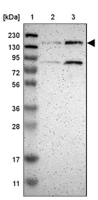 Lane 1: Marker [kDa] 230, 130, 95, 72, 56, 36, 28, 17, 11_br/_Lane 2: Human cell line RT-4_br/_Lane 3: Human cell line U-251MG sp