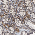 Immunohistochemical staining of human colon shows moderate to strong cytoplasmic positivity in lymphoid cells.