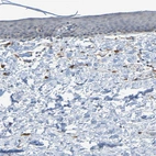 Immunohistochemical staining of human skin shows no positivity in keratinocytes as expected.