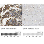 Anti-LASP1 Antibody