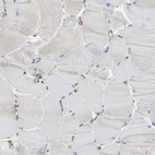Immunohistochemical staining of human skeletal muscle shows low expression as expected.