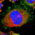 Immunofluorescent staining of human cell line U-251 MG shows localization to plasma membrane, cytosol & focal adhesion sites.