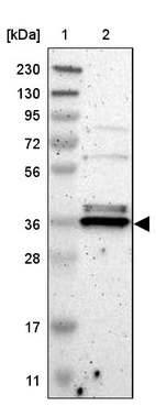Lane 1: Marker [kDa] 230, 130, 95, 72, 56, 36, 28, 17, 11_br/_Lane 2: Human cell line RT-4