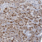 Anti-C3orf18 Antibody