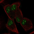 Anti-TCEAL9 Antibody