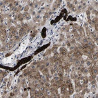 Anti-SCD Antibody