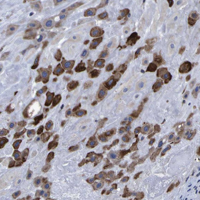Anti-P3H1 Antibody