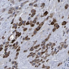 Anti-P3H1 Antibody