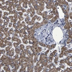 Immunohistochemical staining of human liver shows strong cytoplasmic positivity in hepatocytes.