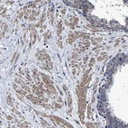 Immunohistochemical staining of human prostate shows moderate cytoplasmic positivity in smooth muscle cells.