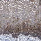 Immunohistochemical staining of human cervix shows weak to moderate cytoplasmic positivity in squamous epithelial cells.