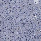Immunohistochemical staining of human pancreas shows no positivity in exocrine glandular cells as expected.