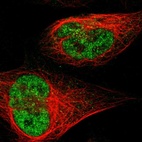 Immunofluorescent staining of human cell line U-2 OS shows localization to nucleoplasm.