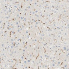 Immunohistochemical staining of human liver shows moderate to strong cytoplasmic positivity in Kupffer cells.