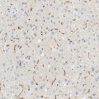 Anti-FCGRT Antibody