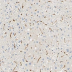Immunohistochemical staining of human liver shows moderate to strong cytoplasmic positivity in Kupffer cells.
