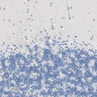 Immunohistochemical staining of human cerebellum shows no positivity in neurons as expected.