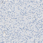 Anti-FCGRT Antibody