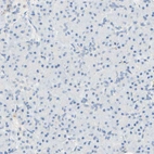 Immunohistochemical staining of human pancreas shows no positivity in exocrine glandular cells as expected.