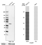 Anti-FCGRT Antibody