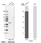 Western blot analysis in human cell lines Caco-2 and HeLa using Anti-FCGRT antibody. Corresponding FCGRT RNA-seq data are presented for the same cell lines. Loading control: Anti-GAPDH.