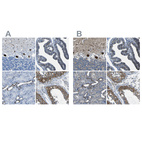 Anti-STIM1 Antibody