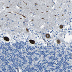 Immunohistochemical staining of human cerebellum shows strong cytoplasmic positivity in Purkinje cells.