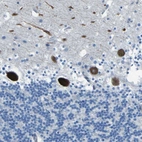 Immunohistochemical staining of human cerebellum shows strong cytoplasmic positivity in Purkinje cells.