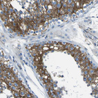 Immunohistochemical staining of human testis shows strong cytoplasmic positivity in cells in seminiferous ducts.